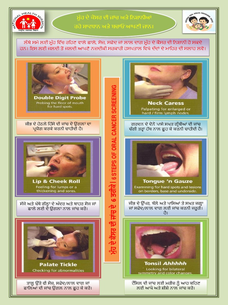 Oral Cancer Screening 6 STEPS PDF