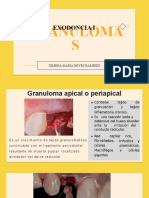 Granuloma
