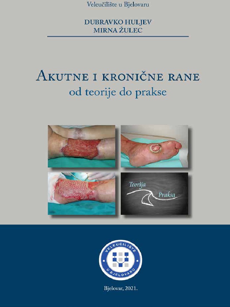 Akutne I Kronicne Rane Verzija Za Web | PDF