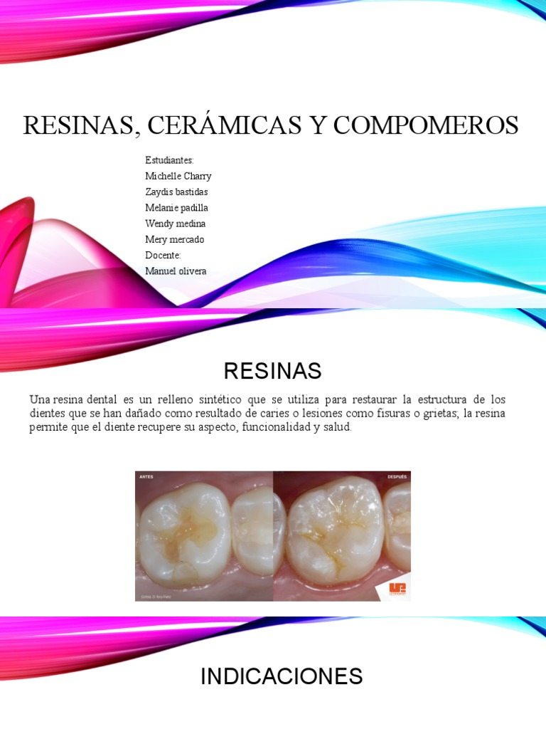 Resinas, Cerámicas y Compómeros Dentales | PDF | Cerámica | Sólido