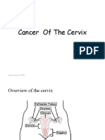 Cervix Cancer Overview: Causes, Symptoms, Diagnosis
