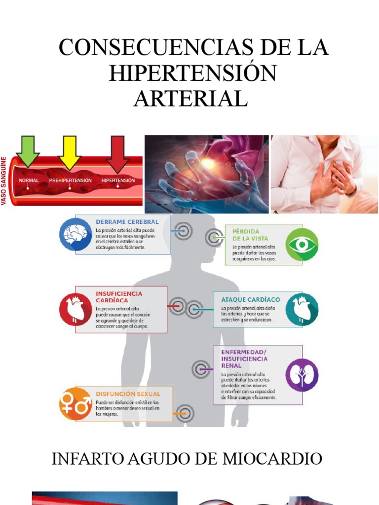 Consecuencias de La Hipertensión Arterial | PDF