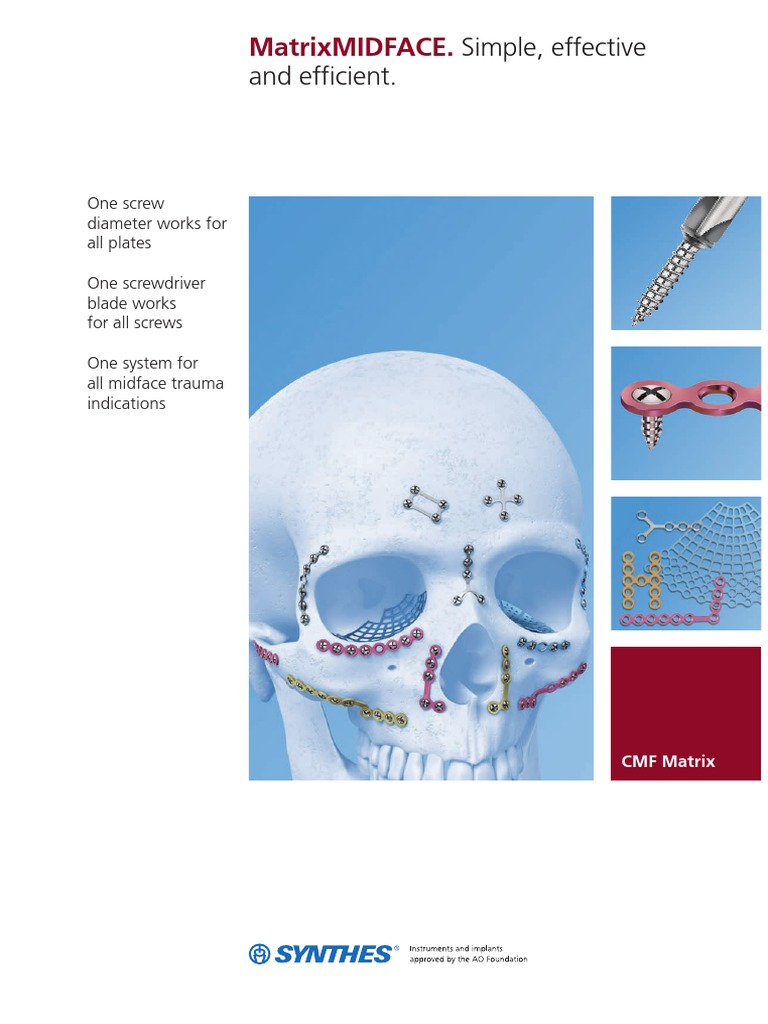 Matrix Midface Download Free PDF Drill Screw