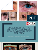 Infection of Eyelids