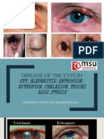 Eyelid Infections and Inflammations Guide