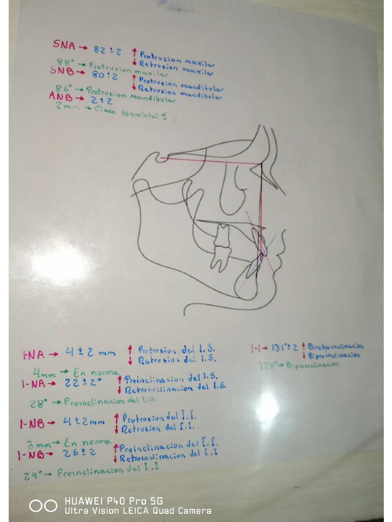 Análisis Cefalometrico de Steiner PDF