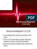 Electrocardiogram (E.C.G)