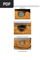 【裁断済】　ITI Treatment Guide Volume1〜10 ITI Treatment Guide: Implant Therapy in the Esthetic Zone