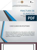 Fractura de Clavicula