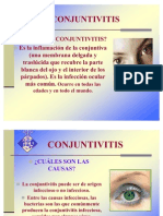 CONJUNTIVITIS