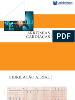 Arritmias Cardã Acas