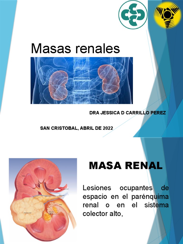 Masas Renales | PDF | Metástasis | Riñón