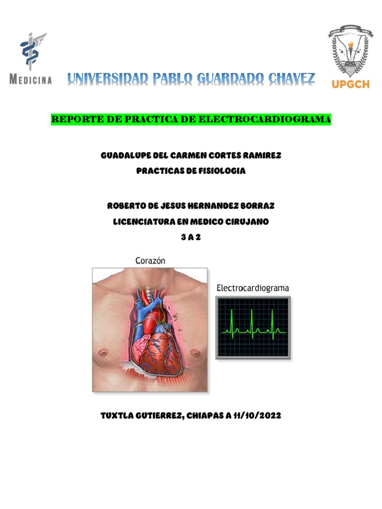 Reporte Practica de Electrocardiograma 3a2 | PDF | Electrocardiografia ...