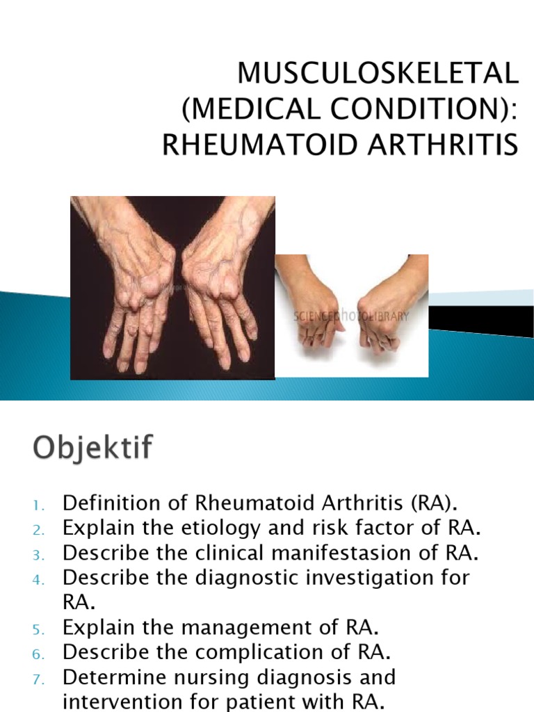 LP Rheumatoid Arthritis PDF