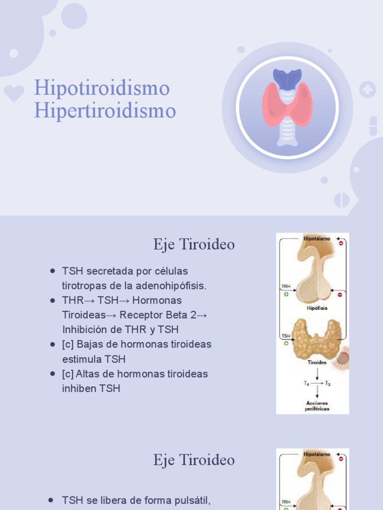 Hipotiroidismo e Hipertiroidismo MI PDF Hipertiroidismo Tiroides