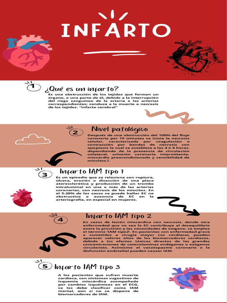 Infarto | PDF | Infarto de miocardio | Enfermedades y trastornos humanos