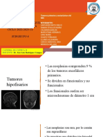 Tumores Primarios y Metastásicos Del SNC