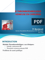 Maladie Thromboembolique en Chirurgie