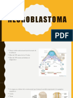 Neuroblastoma: Guía de diagnóstico y tratamiento