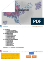 NEOPLASIAS 