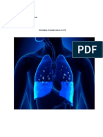 edem-pulmonar