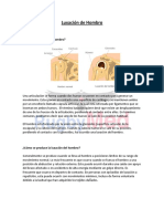 Luxación de Hombro: Causas, Síntomas y Tratamiento