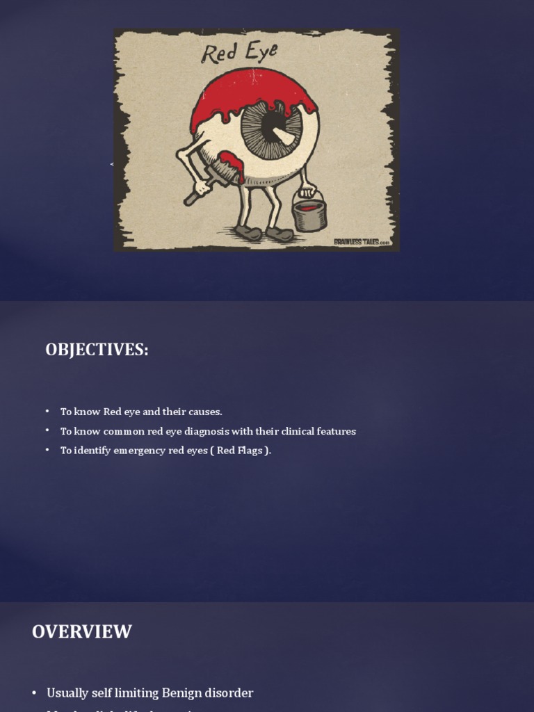 The Red Eye | PDF | Human Eye | Glaucoma
