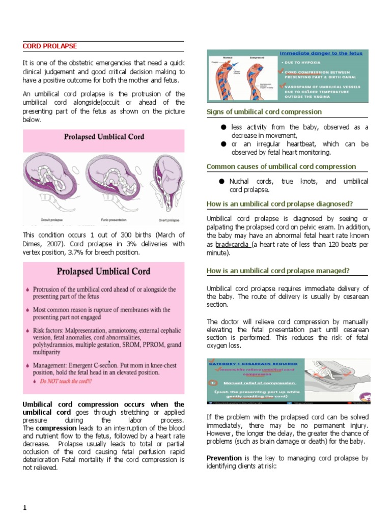 Cord Prolapse PDF Childbirth Health Care