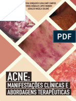 Material de Acne