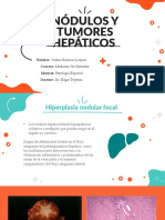 Nodulos y Tumores Hepaticos