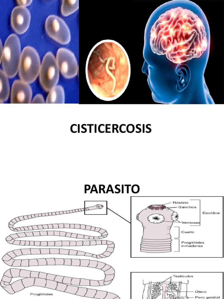 Tema 14 Cisticerco-1 | PDF