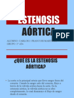 Estenosis Aórtica