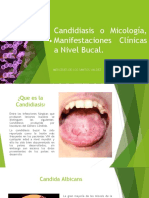 Candidiasis bucal guía