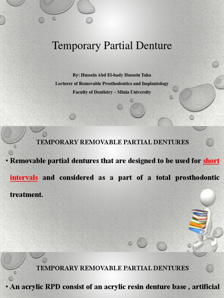 Temporary Partial Denture 3rd Year 22-3-2020 | PDF | Dentures | Health ...
