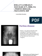Perbedaan Gambaran Radiologis Dari Avn, DDH
