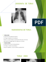 2 Radiografia de Torax