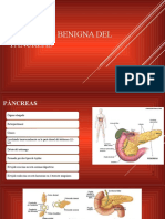 8.1pancreatitis Cirugia