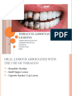 Tobacco-Associated Oral Lesions