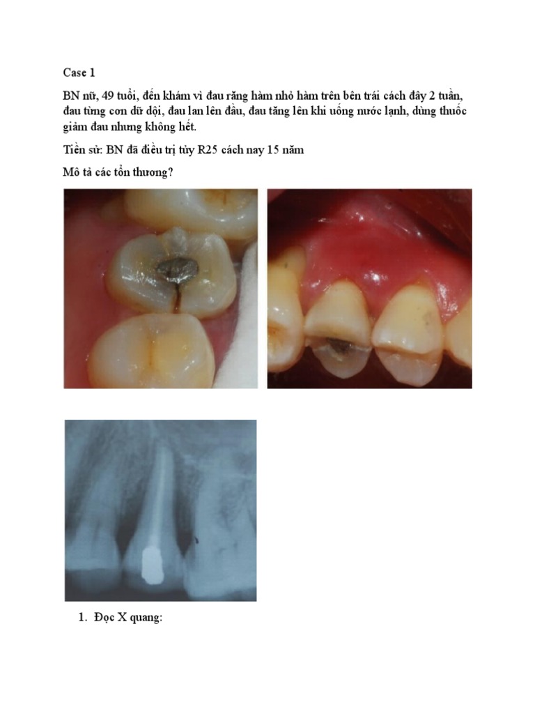Case T y | PDF
