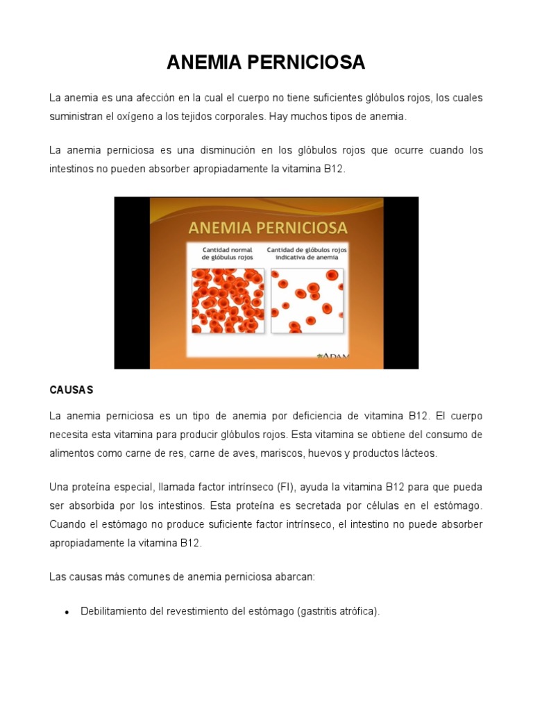 Anemia Perniciosa PDF Esclerosis múltiple Vitamina B12
