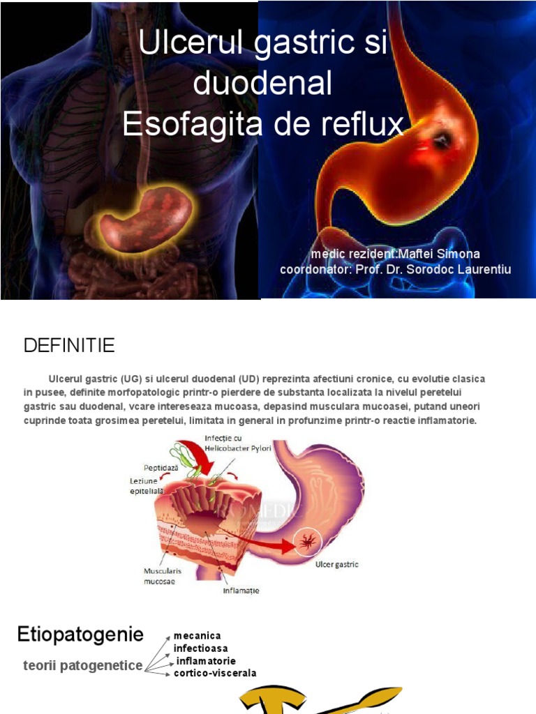 Maftei Simona Ulcerul Gastric Și Duodenal, Esofagita de Reflux | PDF
