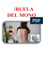 Viruela Del Mono