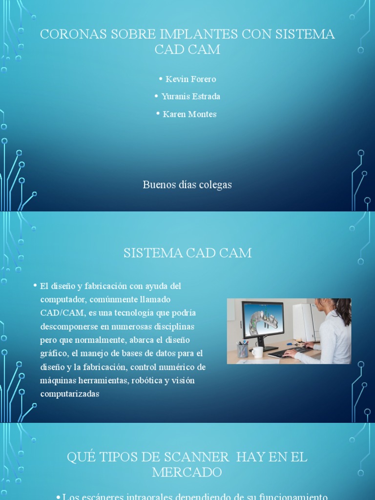 Coronas CAD/CAM en Implantes Dentales | PDF | Implante dental ...