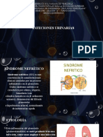 Diapositiva Exposición