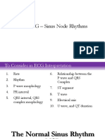 The Ecg Ii PDF
