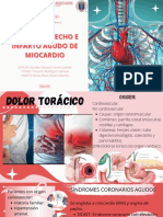 Angina de Pecho e Infarto Agudo de Miocardio PDF