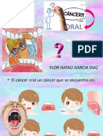 Cancer Oral