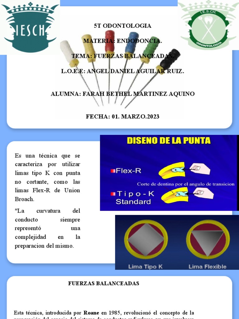 Fuerzas Balanceadas. Endodoncia. Fbma | PDF