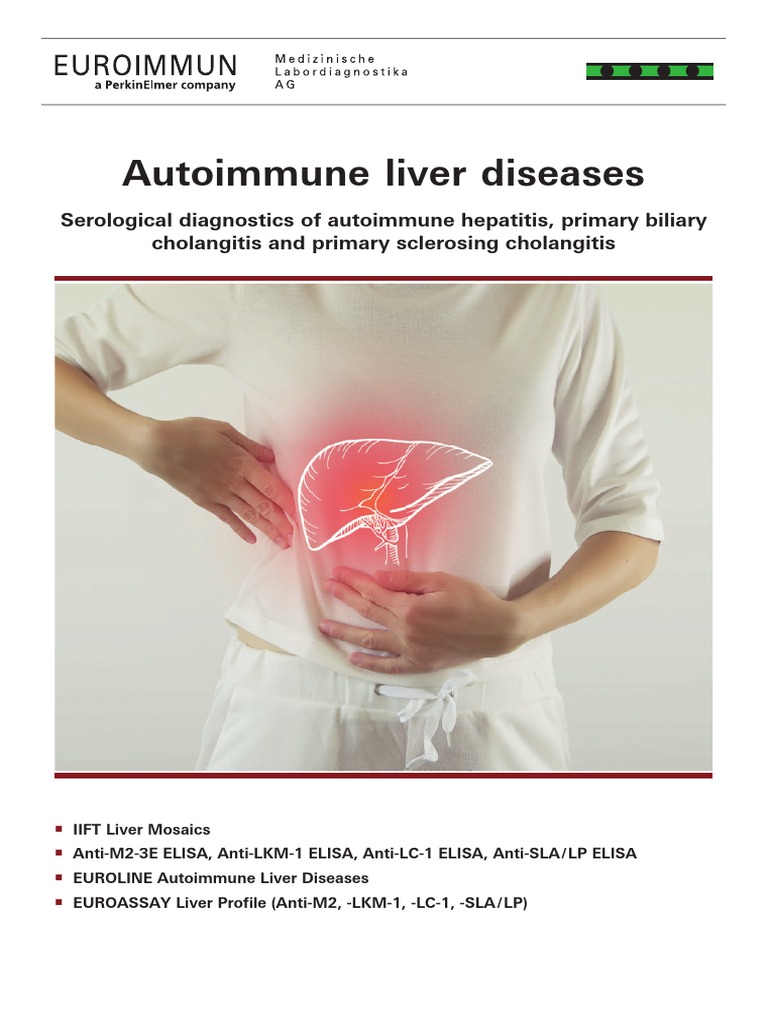 Autoimmune Liver Diseases PDF Serology Hepatitis