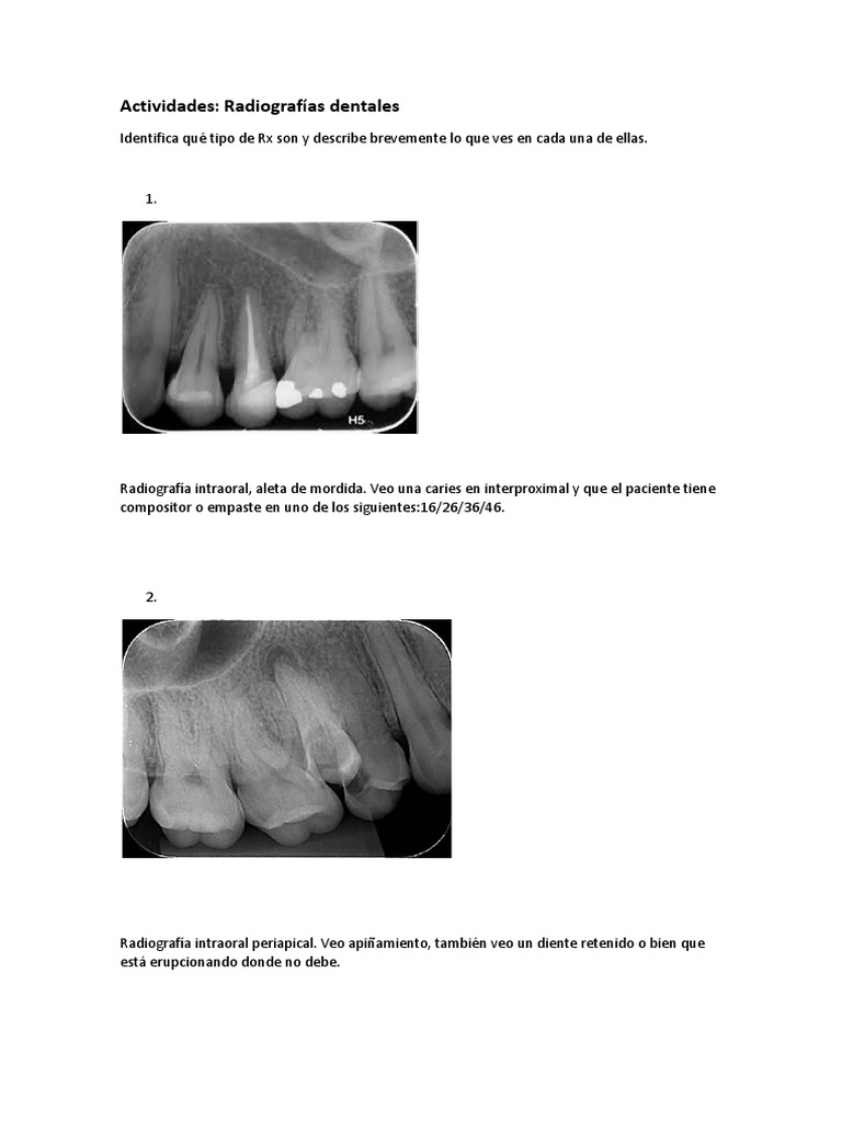 Tarea RX Intraoral - Extraoral | PDF | Diente | Especialidades Medicas